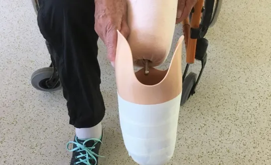 Prothesenhandling: Prothese anziehen 1 Prothesenhandling: Prothese anziehen 1