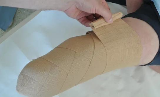 Stumpfbandage: Schritt 6 Stumpfbandage: Schritt 6