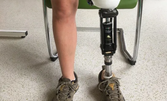 Prothesenhandling: Vakuum anziehen 2 Prothesenhandling: Vakuum anziehen 2