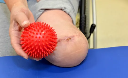 Sensibilitätstraining am Stumpf Sensibilitätstraining am Stumpf