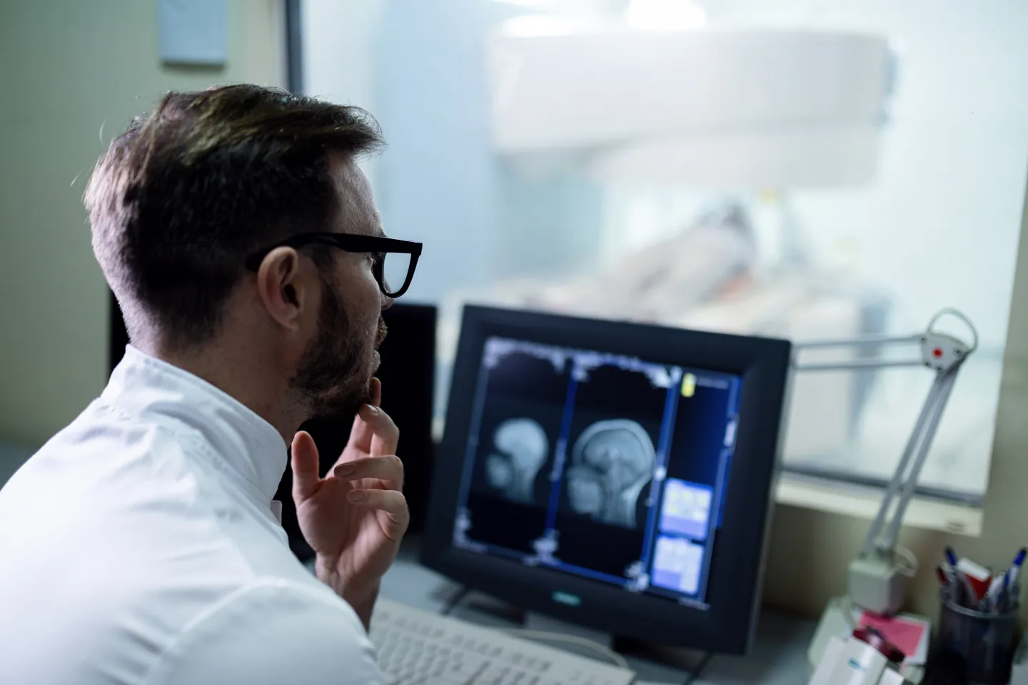 Arzt untersucht am Computerscreen das Hirn-MRT-Scan-Ergebnis eines Patienten.