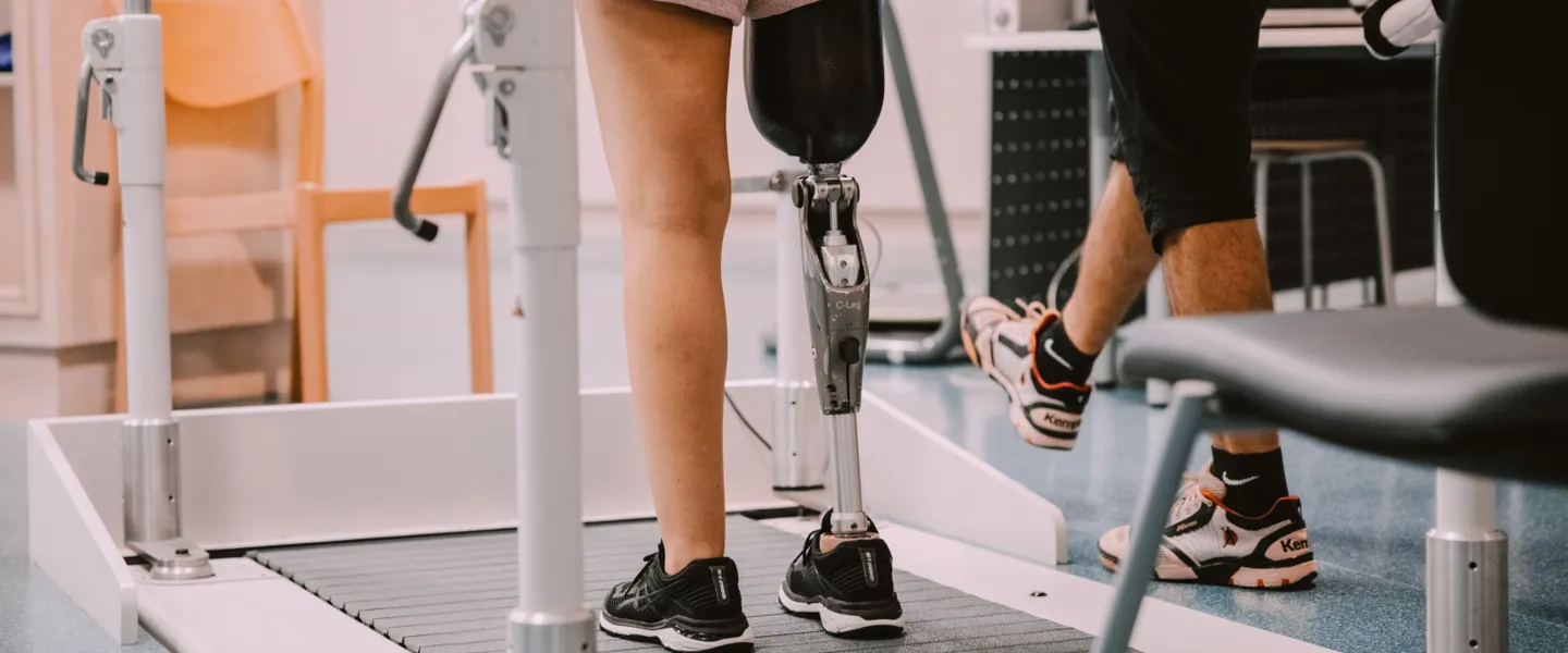 Einer Patientin wird nach einer Beinamputation mit moderner Orthopädietechnik geholfen, ihre Mobilität wiederzuerlangen.