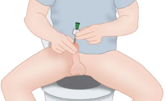 RH Selbstkatheterismus auf der Toilette (männl.) - Symbolbild Ratgeber Querschnittlähmung Selbstkatheterismus auf der Toilette (männl.) - Symbolbild für Ratgeber Querschnittlähmung