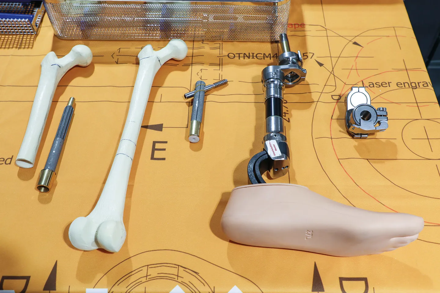 Transkutane osseointegrierte Unterschenkelprothese (Badal X System) der Fa. OTN Implants B.V.