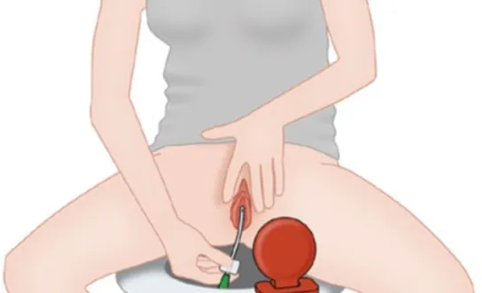 RH Selbstkatheterismus auf der Toilette (weibl.) - Ratgeber Querschnittlähmung Selbstkatheterismus auf der Toilette (weibl.) - Symbolbild für Ratgeber Querschnittlähmung