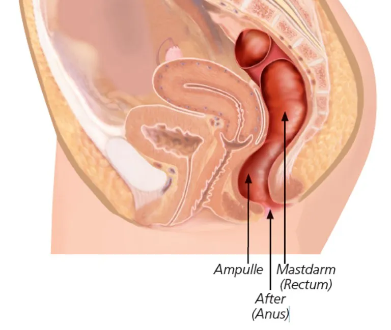 RH Illustrationsmastdarm - Symbolbild Ratgeber Querschnittlähmung Illustrationsmastdarm - Symbolbild für Ratgeber Querschnittlähmung