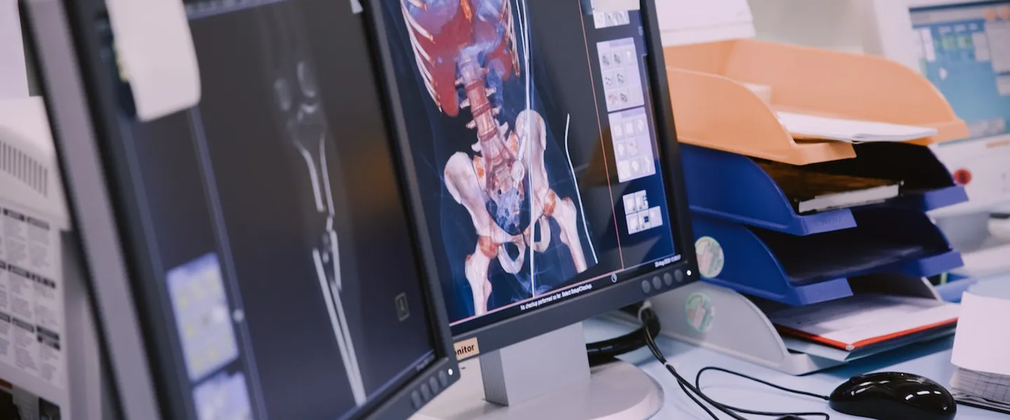Ein auf einem Computerbildschirm abgebildetes Röntgenbild
