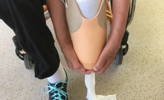 Prothesenhandling: Weichwandschaft 1 Prothesenhandling: Weichwandschaft 1