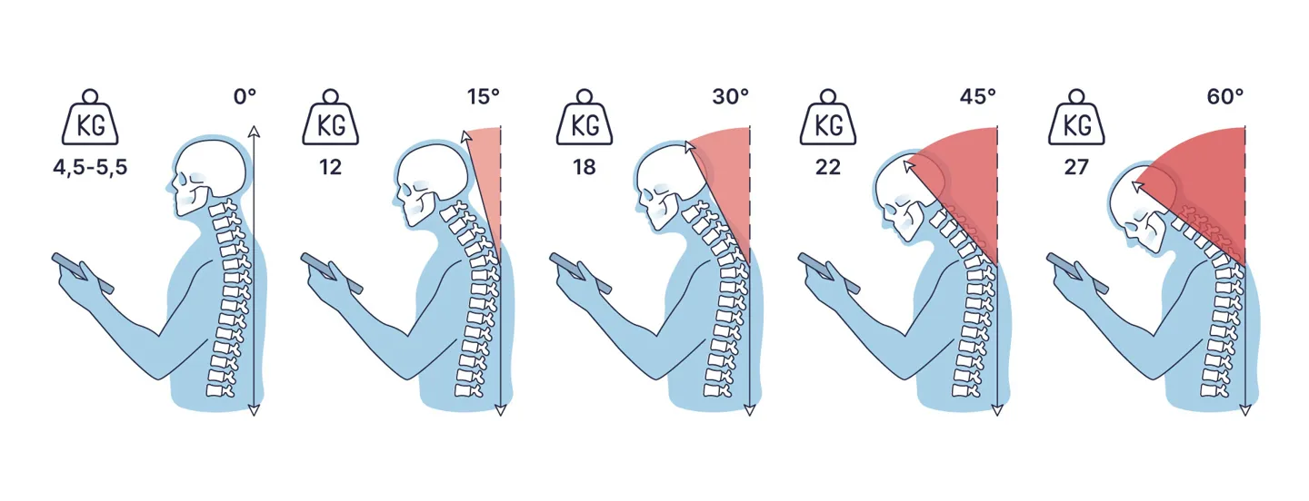 Haltung Smartphone Blog Anpassung ©L.Hofreiter Illustration der Belastung der Nackenmuskulatur bei Handynutzung