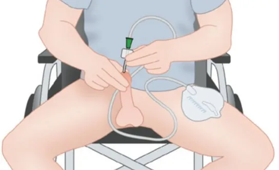 RH Selbstkatheterismus am Rollstuhl sitzend (männl.) - Ratgeber Querschnittlähmung Selbstkatheterismus am Rollstuhl sitzend (männl.) - Symbolbild für Ratgeber Querschnittlähmung