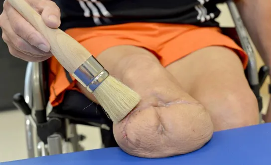 Massage des Stumpfes Massage des Stumpfes