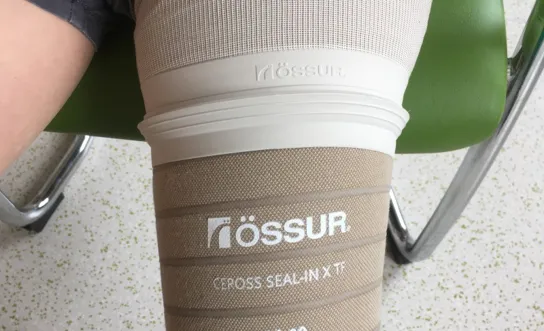 Prothesenhandling: Dichtungsring 2 Prothesenhandling: Dichtungsring 2